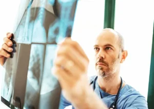 First stage of lung cancer (3)