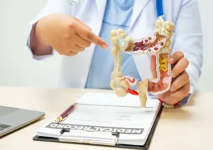 Best way to cure constipation (3)