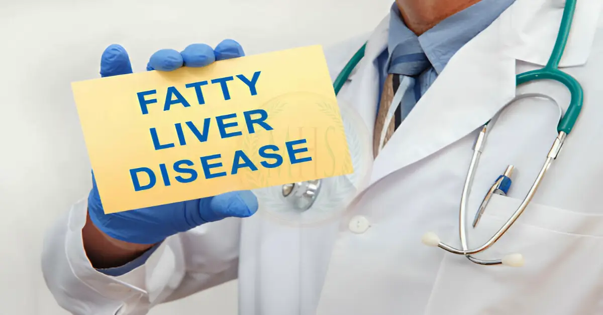 What is the fatty liver? what is the treatment for fatty liver?