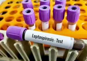 Leptospirosis prevention and control (2)