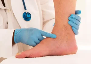 Varicose veins medical definition (1)