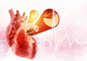 Cough with heart disease (1)