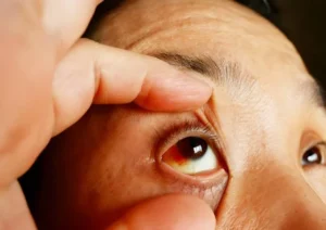 Diabetic Eye Care Tips (2)