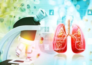 Last stage of lung cancer (1)