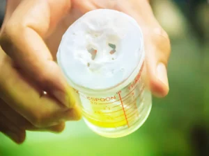 Foamy urine diabetes (1)