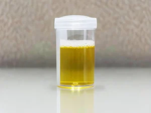 Foamy urine diabetes (2)