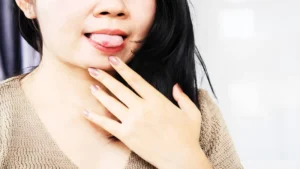 Mouth Ulcers_ Types, Causes, and When to Worry (1)