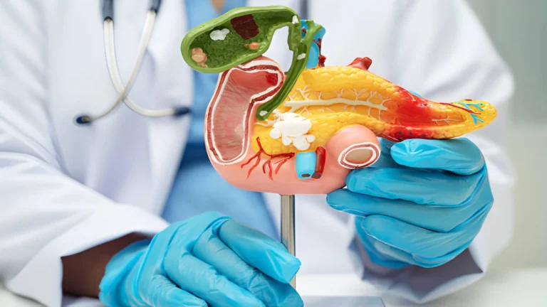 Pancreatic cancer causes