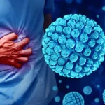 What is the norovirus